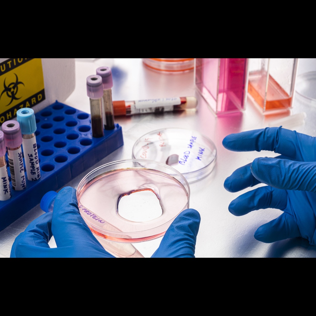 C1q Native Protein from Human Complement   0.2mg